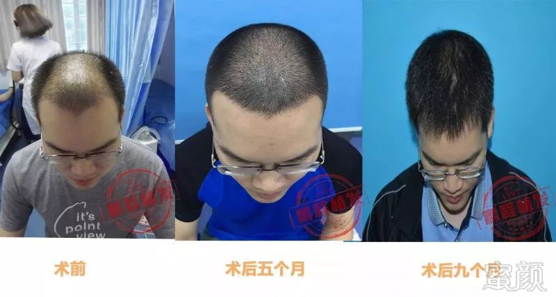 https://img.miyanlife.com/mnt/timg/180510/12344T319-7.jpg