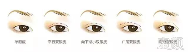 https://img.miyanlife.com/mnt/timg/180510/1242094L5-3.jpg