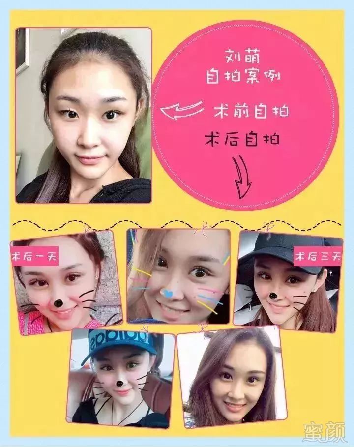https://img.miyanlife.com/mnt/timg/180510/1242102V5-6.jpg