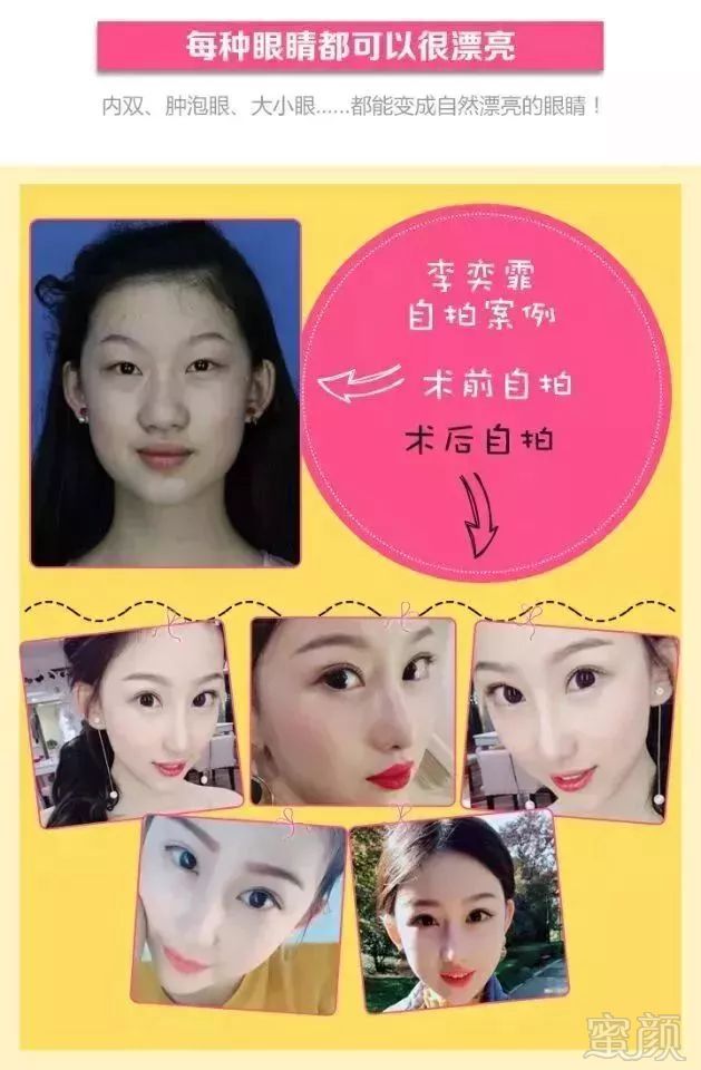 https://img.miyanlife.com/mnt/timg/180510/124210HX-5.jpg