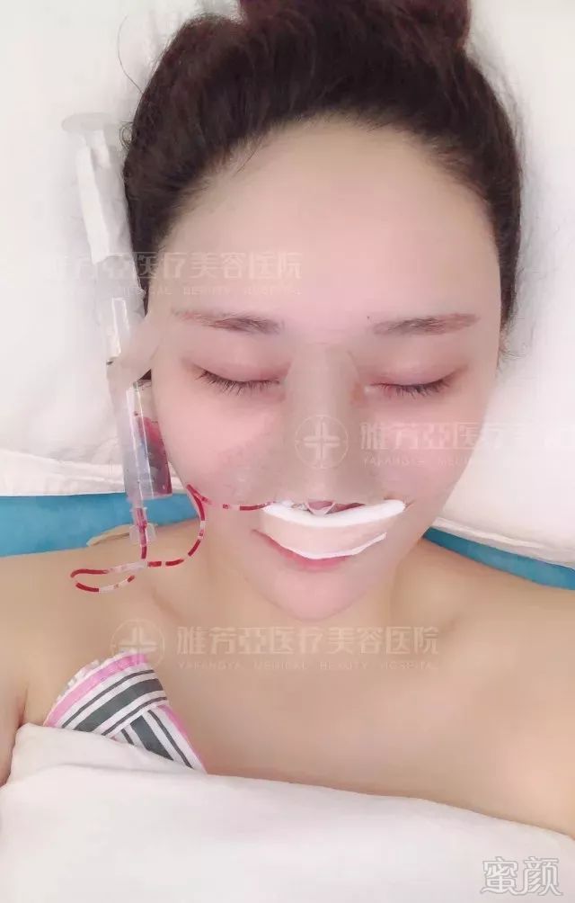 https://img.miyanlife.com/mnt/timg/180510/124F9A34-11.jpg
