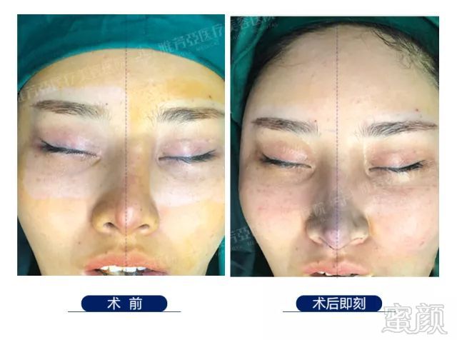 https://img.miyanlife.com/mnt/timg/180510/124G0J11-12.jpg