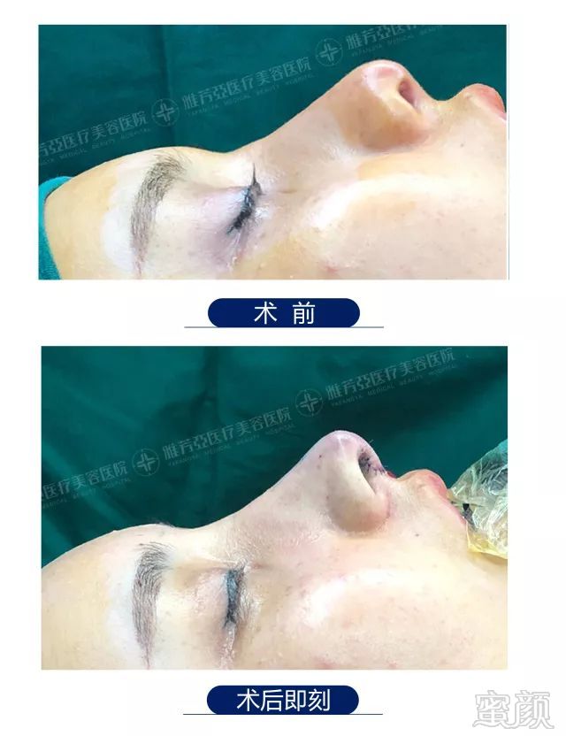 https://img.miyanlife.com/mnt/timg/180510/124G14451-13.jpg