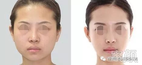 https://img.miyanlife.com/mnt/timg/180510/1253295X6-1.jpg