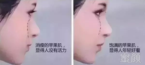 案例图片