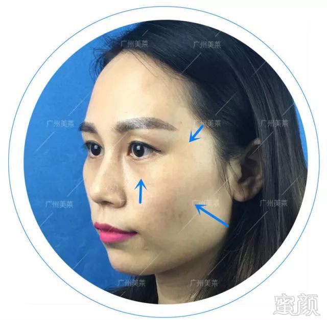 https://img.miyanlife.com/mnt/timg/180510/1343346302-5.jpg