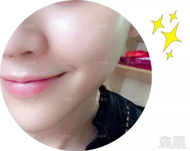 https://img.miyanlife.com/mnt/timg/180510/134345LO-15.jpg
