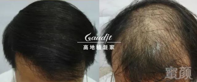 https://img.miyanlife.com/mnt/timg/180511/1140511b8-7.jpg