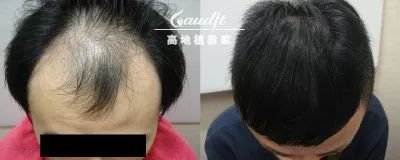 https://img.miyanlife.com/mnt/timg/180511/11405151U-5.jpg