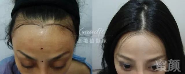 https://img.miyanlife.com/mnt/timg/180511/1140515551-6.jpg