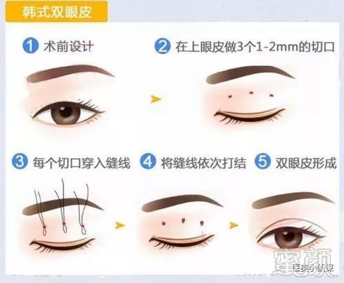 https://img.miyanlife.com/mnt/timg/180511/1142201560-0.jpg