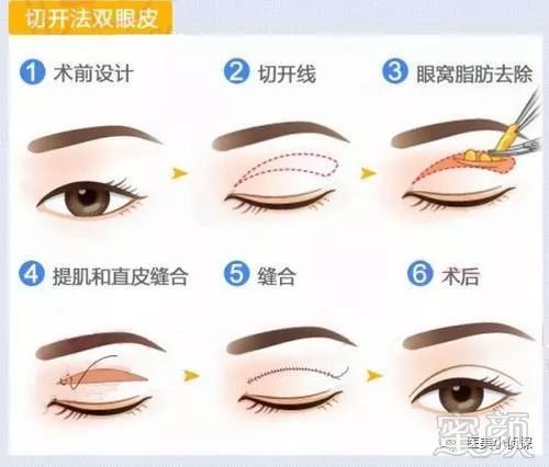 https://img.miyanlife.com/mnt/timg/180511/1142203516-2.jpg