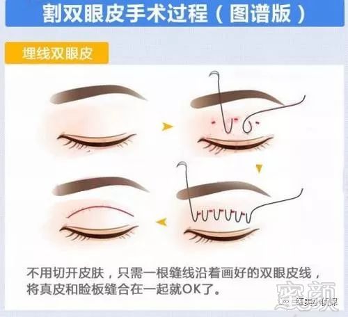 https://img.miyanlife.com/mnt/timg/180511/114220L55-1.jpg