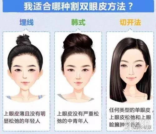 https://img.miyanlife.com/mnt/timg/180511/1142216248-5.jpg