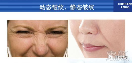 https://img.miyanlife.com/mnt/timg/180511/121GJ102-0.jpg