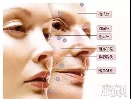 https://img.miyanlife.com/mnt/timg/180511/1220003258-0.jpg