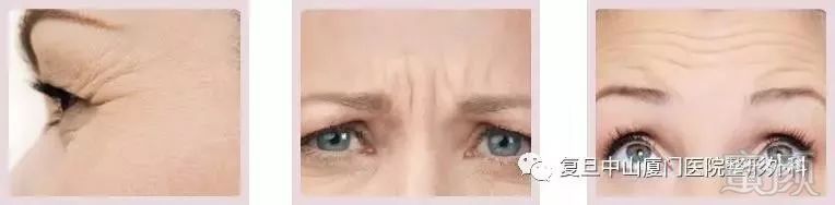 https://img.miyanlife.com/mnt/timg/180511/122000MO-1.jpg
