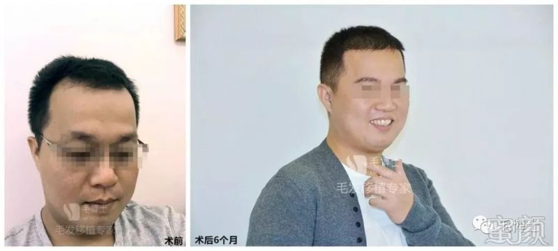 https://img.miyanlife.com/mnt/timg/180511/12263142X-5.jpg