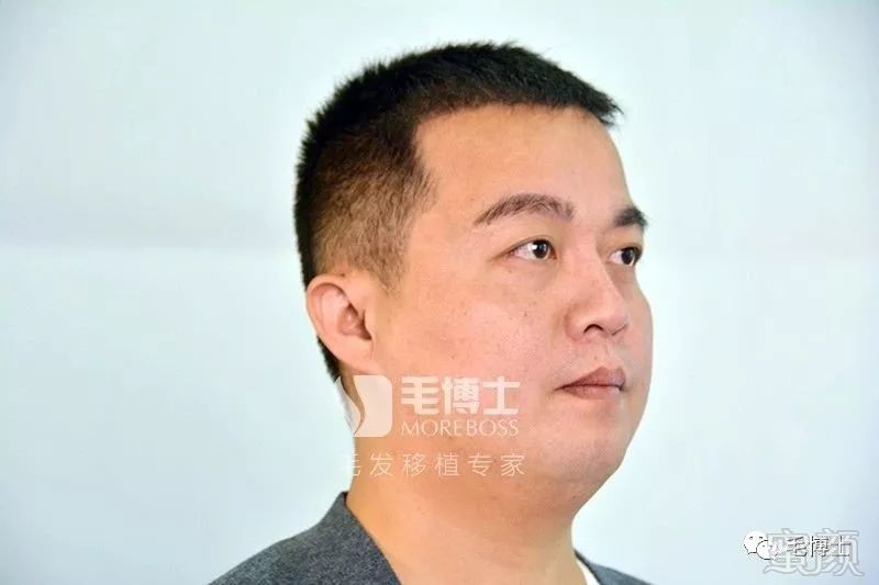 https://img.miyanlife.com/mnt/timg/180511/12264A145-15.jpg