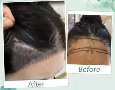 https://img.miyanlife.com/mnt/timg/180511/122G03138-3.jpg