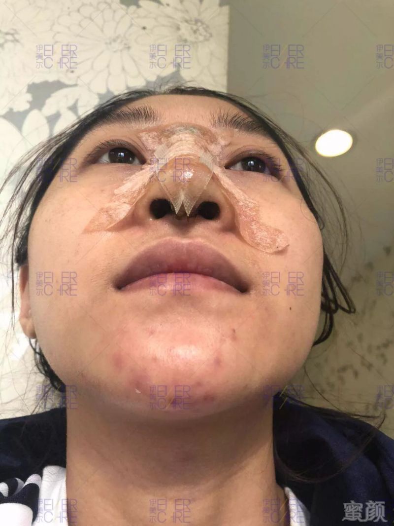 https://img.miyanlife.com/mnt/timg/180511/1233261094-11.jpg