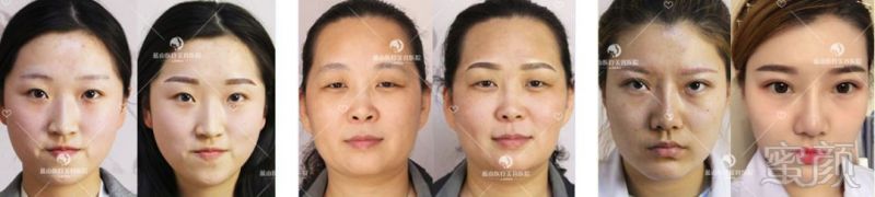 https://img.miyanlife.com/mnt/timg/180511/124F350M-7.jpg