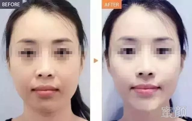 https://img.miyanlife.com/mnt/timg/180511/1302361964-1.jpg