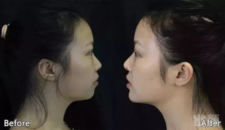 https://img.miyanlife.com/mnt/timg/180511/1309492H9-4.jpg