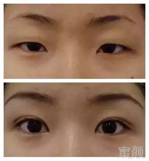 https://img.miyanlife.com/mnt/timg/180511/1312264205-11.jpg