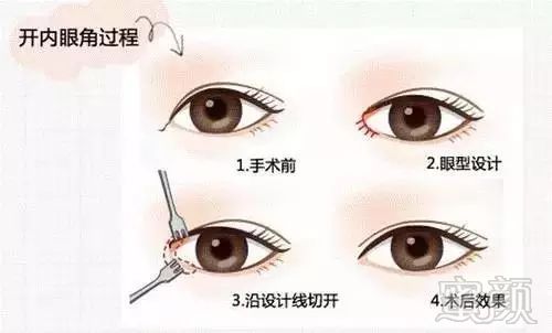 https://img.miyanlife.com/mnt/timg/180511/13122AK5-9.jpg