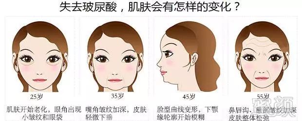 https://img.miyanlife.com/mnt/timg/180511/154F02133-2.jpg