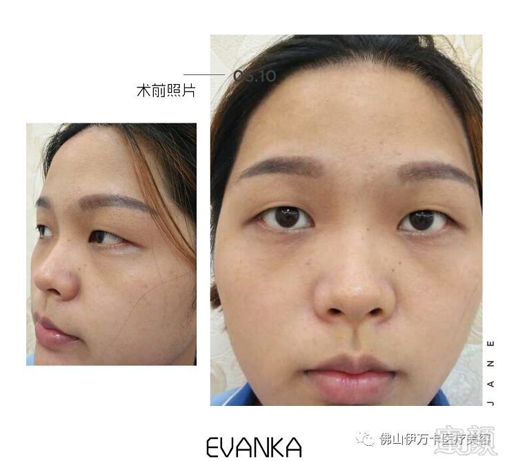 https://img.miyanlife.com/mnt/timg/180512/11255342P-5.jpg