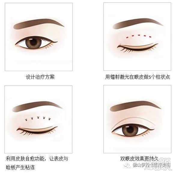 https://img.miyanlife.com/mnt/timg/180512/1125543028-10.jpg