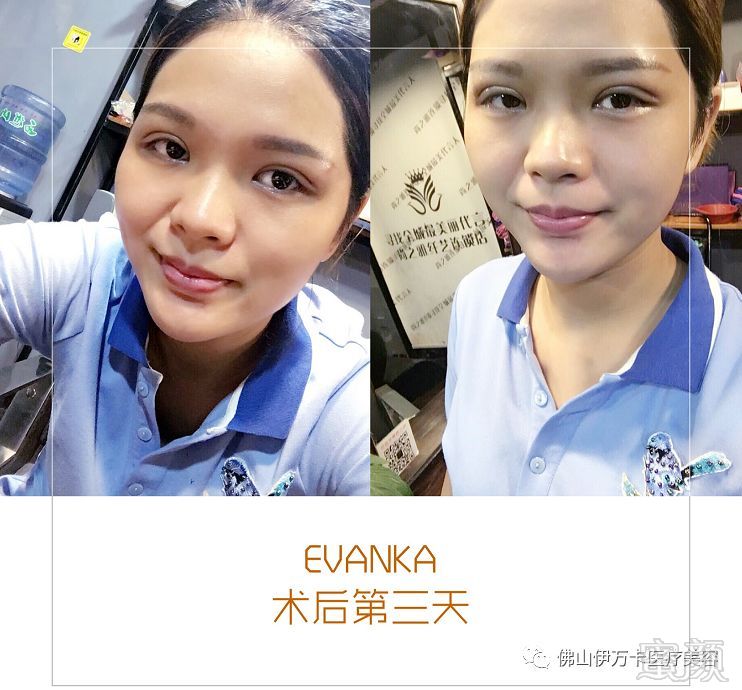 https://img.miyanlife.com/mnt/timg/180512/1125545N1-8.jpg