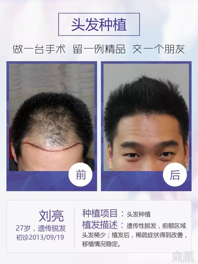 https://img.miyanlife.com/mnt/timg/180512/1202492H1-9.jpg