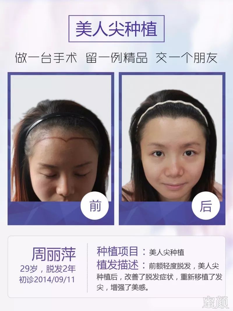 https://img.miyanlife.com/mnt/timg/180512/1202495117-8.jpg