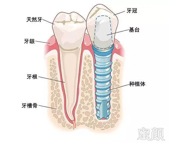 案例图片