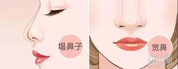https://img.miyanlife.com/mnt/timg/180512/12315KU6-5.jpg