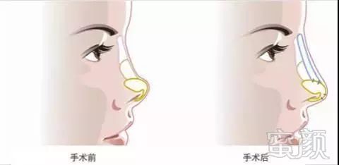https://img.miyanlife.com/mnt/timg/180512/12315Mc6-4.jpg
