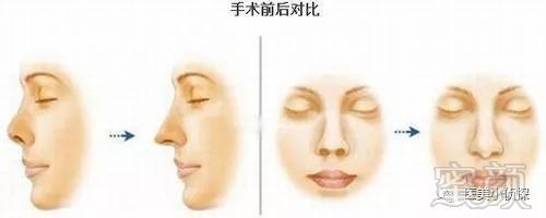 https://img.miyanlife.com/mnt/timg/180512/1232194259-1.jpg