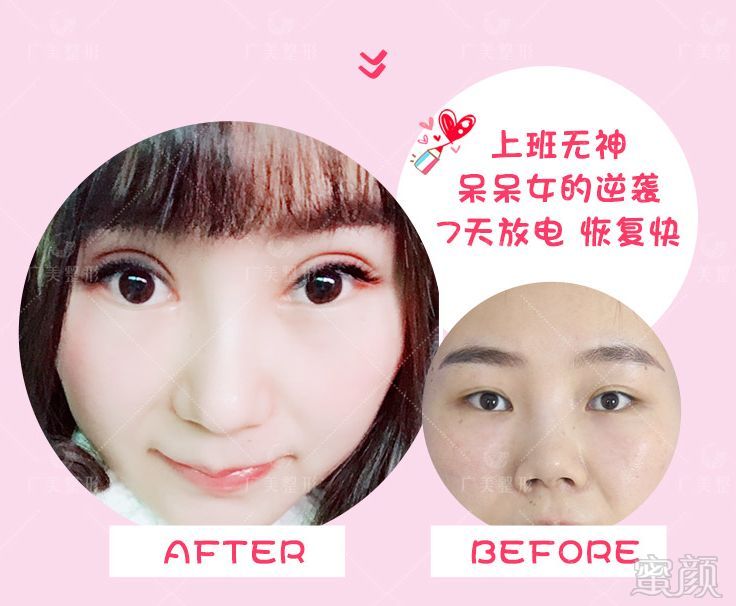 https://img.miyanlife.com/mnt/timg/180512/125J53258-10.jpg