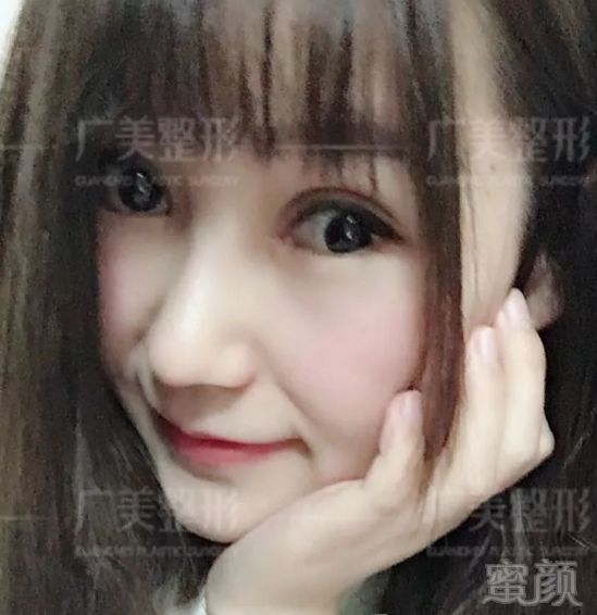 https://img.miyanlife.com/mnt/timg/180512/125J56000-9.jpg