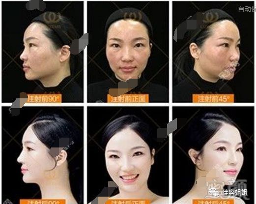 https://img.miyanlife.com/mnt/timg/180512/13145JQ3-1.jpg