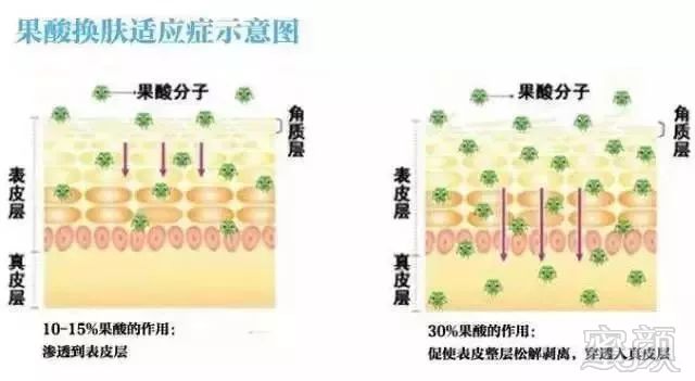 https://img.miyanlife.com/mnt/timg/180513/1052202350-4.jpg