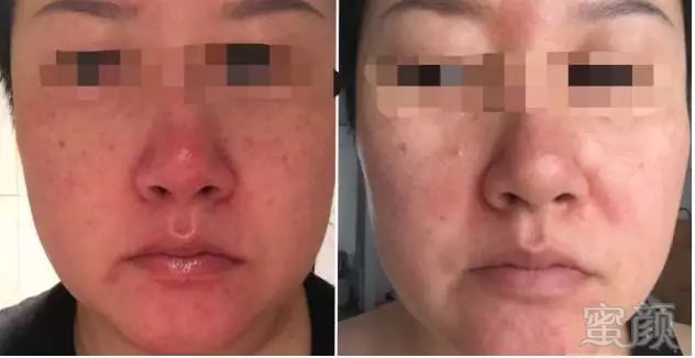 https://img.miyanlife.com/mnt/timg/180513/1052203Z6-5.jpg
