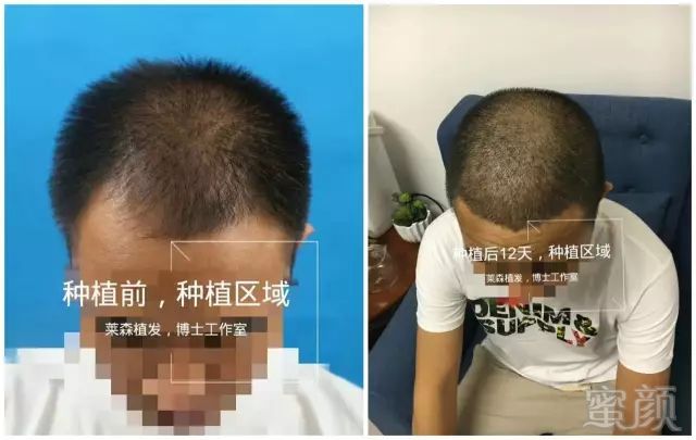 https://img.miyanlife.com/mnt/timg/180513/1103062D6-3.jpg
