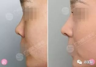 https://img.miyanlife.com/mnt/timg/180513/112433Ba-1.jpg