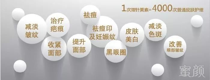 https://img.miyanlife.com/mnt/timg/180513/1130545410-2.jpg