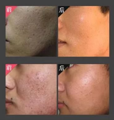 https://img.miyanlife.com/mnt/timg/180513/113059C46-6.jpg