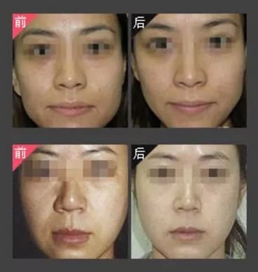 https://img.miyanlife.com/mnt/timg/180513/11305M616-4.jpg